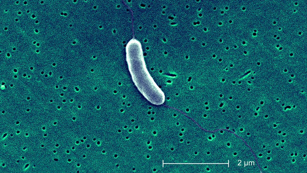 Gambar mikroskop bakteri Vibrio vulnificus