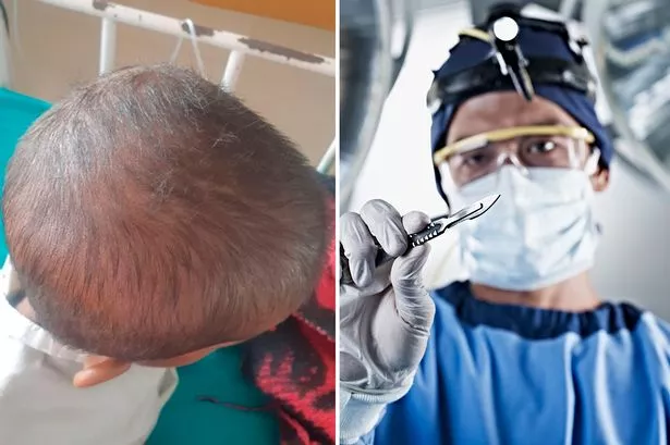 Seorang gadis berusia 4 tahun dilarikan ke rumah sakit dengan benjolan di perutnya sebelum dokter yang panik mengetahui apa benjolan itu Seorang gadis berusia 4 tahun dilarikan ke rumah sakit dengan benjolan di perutnya sebelum dokter yang panik mengetahui apa benjolan itu
