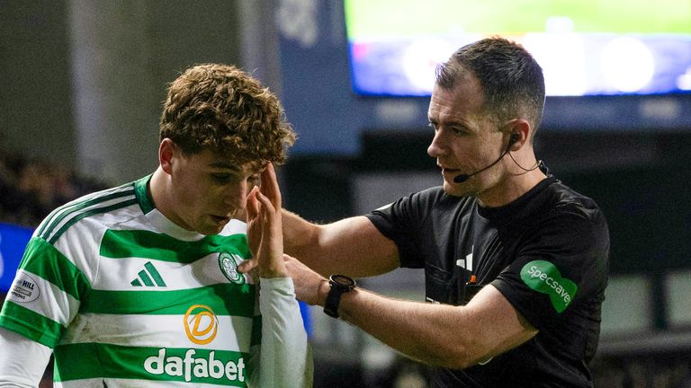 Arne Engels dari Celtic dipukul dengan koin di Ibrox