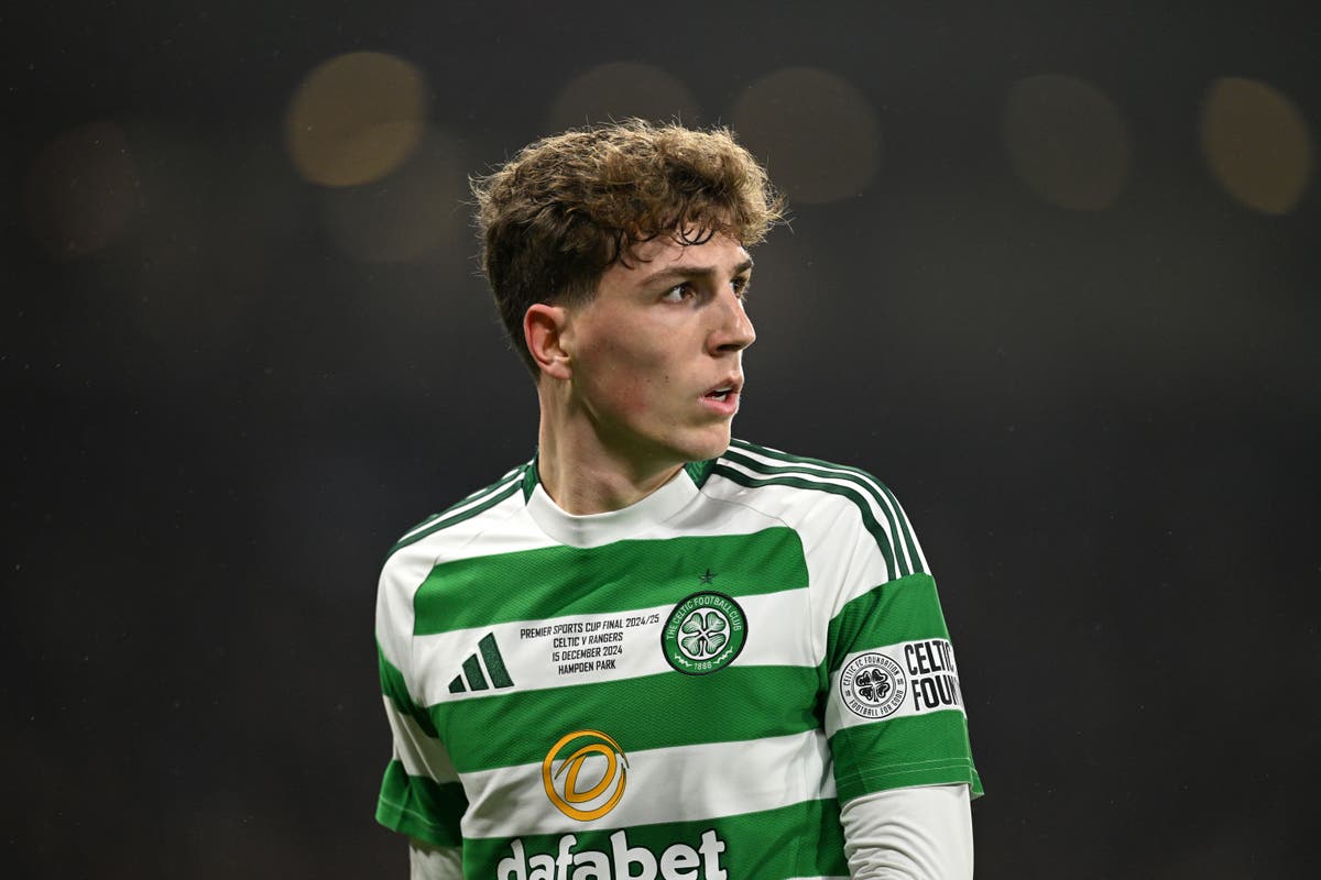 Bek Celtic menyerukan rasa hormat setelah rekan setimnya memukul dengan koin selama derby Old Firm Bek Celtic menyerukan rasa hormat setelah rekan setimnya memukul dengan koin selama derby Old Firm