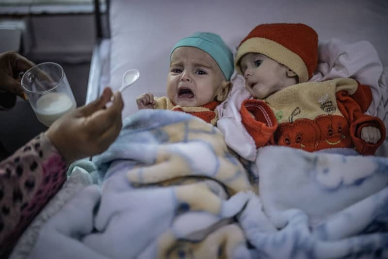 Setengah juta anak-anak Afghanistan berisiko kekurangan gizi pada tahun 2025 Setengah juta anak-anak Afghanistan berisiko kekurangan gizi pada tahun 2025